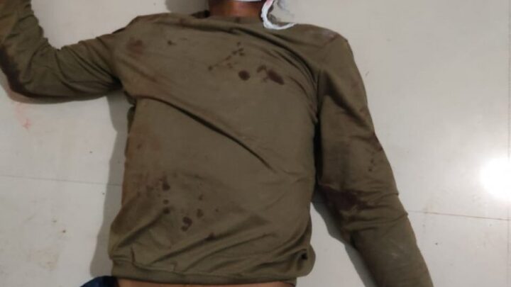 पिकअप और बाइक में जबरदस्त भिड़ंत ” एक की मौत दूसरे की स्तिथि गंभीर,अंबिकापुर रेफर,जांच में जुटी पुलिस