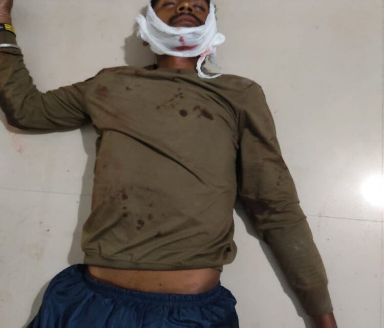 पिकअप और बाइक में जबरदस्त भिड़ंत ” एक की मौत दूसरे की स्तिथि गंभीर,अंबिकापुर रेफर,जांच में जुटी पुलिस