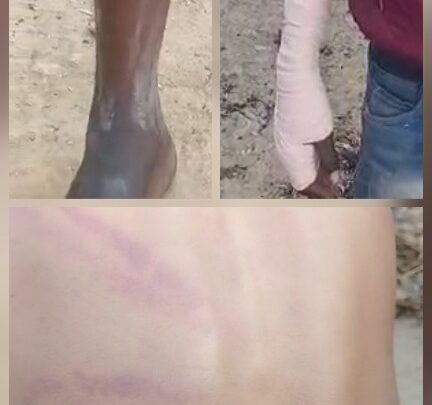 कबाड़ चुनने वाले 18 वर्षीय युवक को रसूखदारों ने जानवरों की तरह पीटा