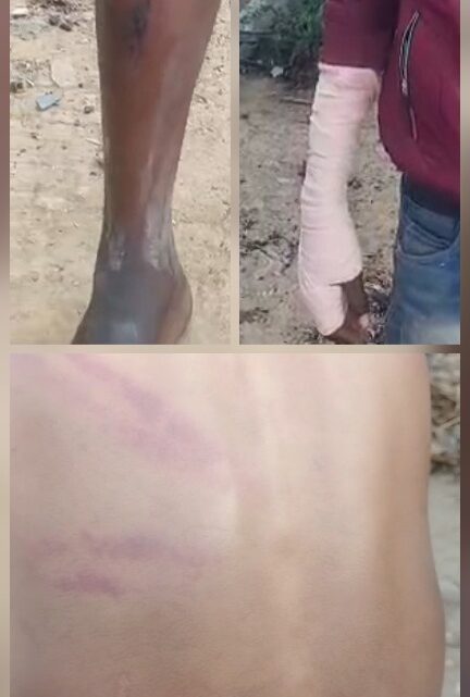 कबाड़ चुनने वाले 18 वर्षीय युवक को रसूखदारों ने जानवरों की तरह पीटा