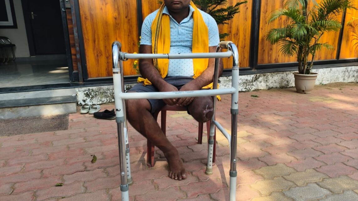 एक हादसे में अपना एक पैर गवां चुके पुरेन्द्र का रायपुर में लगेगा नया कृत्रिम पैर मुख्यमंत्री कैंप कार्यालय में प्रस्तुत आवेदन पर सुनिश्चित की गई आवश्यक कार्यवाही श्री पुरेन्द्र ने मुख्यमंत्री के प्रति किया आभार व्यक्त